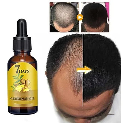 Ginger Hair Oil, Hair Growth, Scalp Nourishment, Non-Greasy Formula, Healthy Hair, Hair Restoration, Natural Hair Care, Thicker Hair, Nourishing Oil, Hair Care.